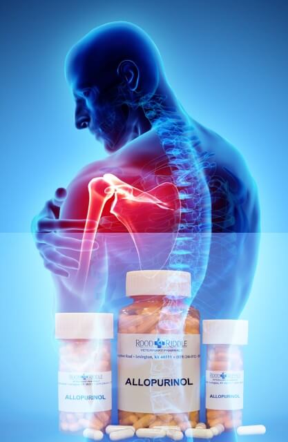 Shoulder Gout Pain and Allopurinol