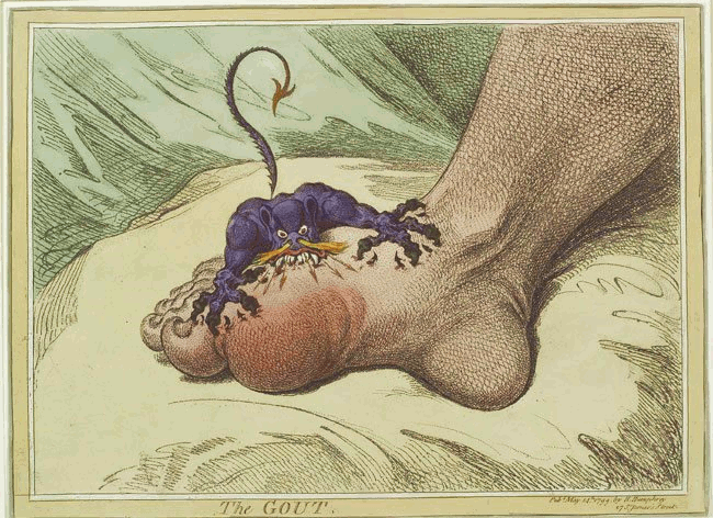 The Gout - James Gillray